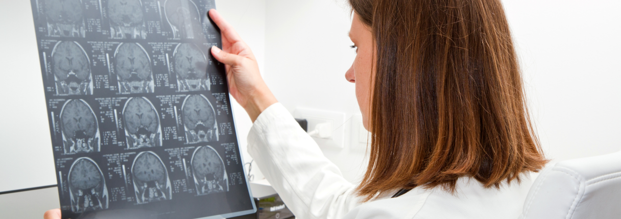 Tomografia da cabeça