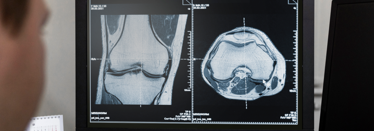 tomografia do joelho